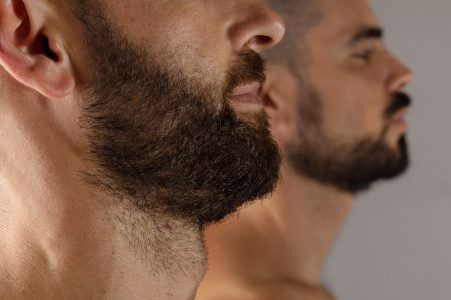 Me están saliendo calvas en la barba: tratamiento y prevención